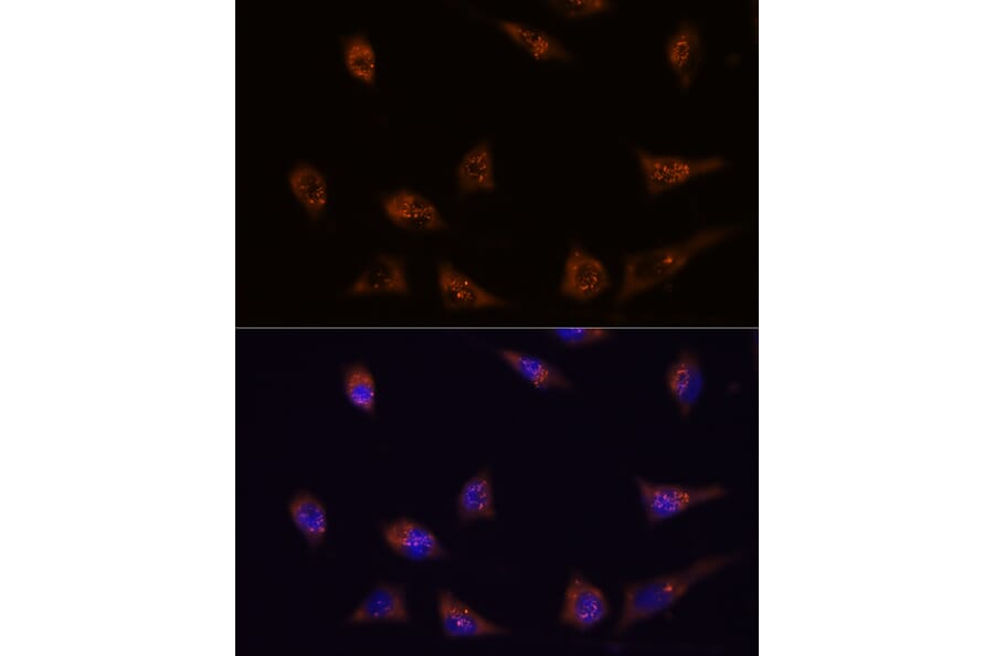 Immunofluorescence - Anti-DIP2C Antibody (A306514) - Antibodies.com