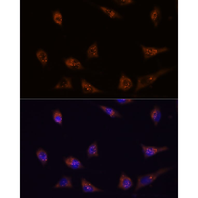 Immunofluorescence - Anti-DIP2C Antibody (A306514) - Antibodies.com