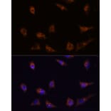 Immunofluorescence - Anti-DIP2C Antibody (A306514) - Antibodies.com