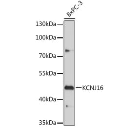 Western Blot - Anti-KCNJ16 Antibody (A306516) - Antibodies.com