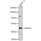 Western Blot - Anti-KCNJ16 Antibody (A306516) - Antibodies.com