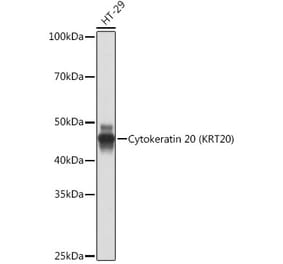 Western Blot - Anti-Cytokeratin 20 Antibody [ARC0288] (A306519) - Antibodies.com