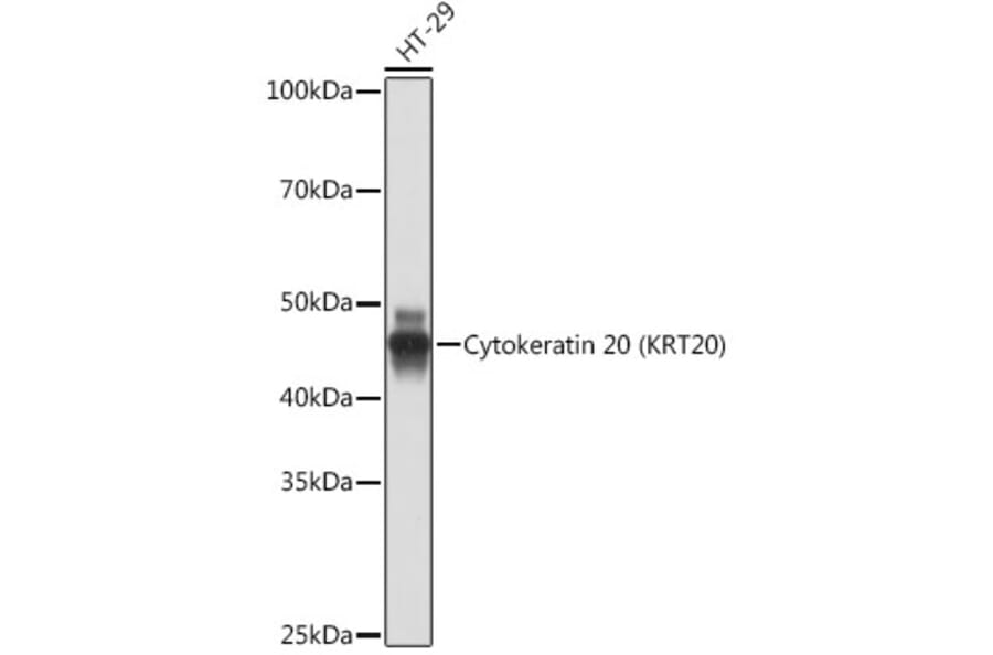 Western Blot - Anti-Cytokeratin 20 Antibody [ARC0288] (A306519) - Antibodies.com