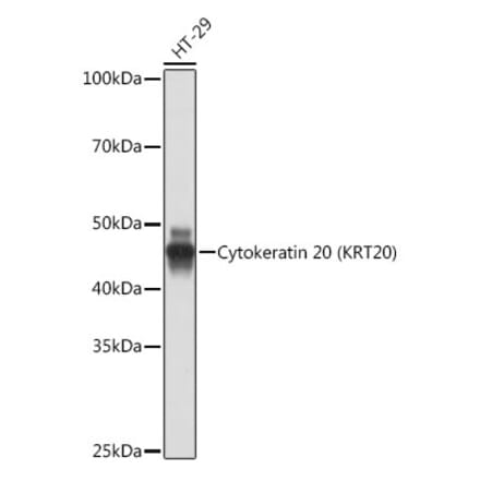 Western Blot - Anti-Cytokeratin 20 Antibody [ARC0288] (A306519) - Antibodies.com