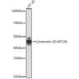 Western Blot - Anti-Cytokeratin 20 Antibody [ARC0288] (A306519) - Antibodies.com