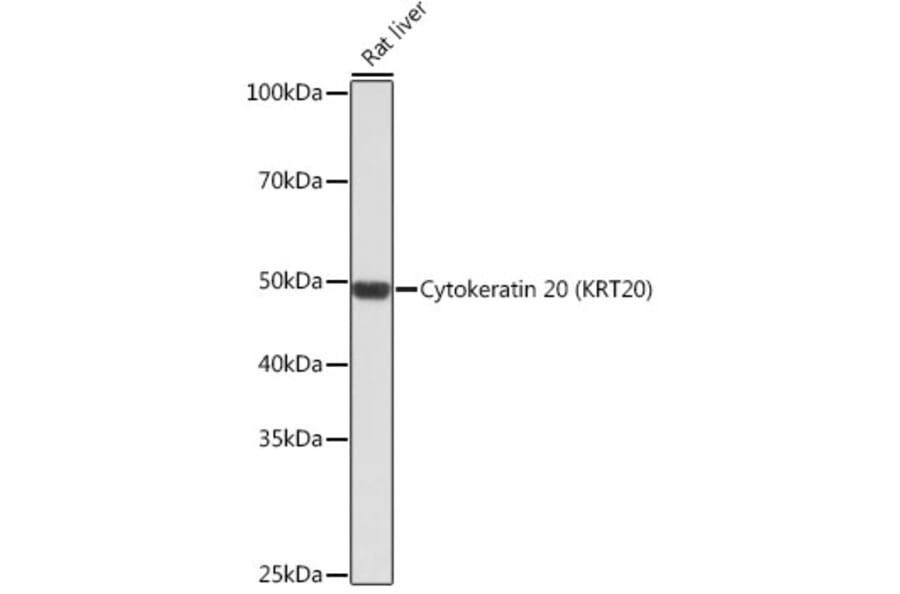 Western Blot - Anti-Cytokeratin 20 Antibody [ARC0288] (A306519) - Antibodies.com