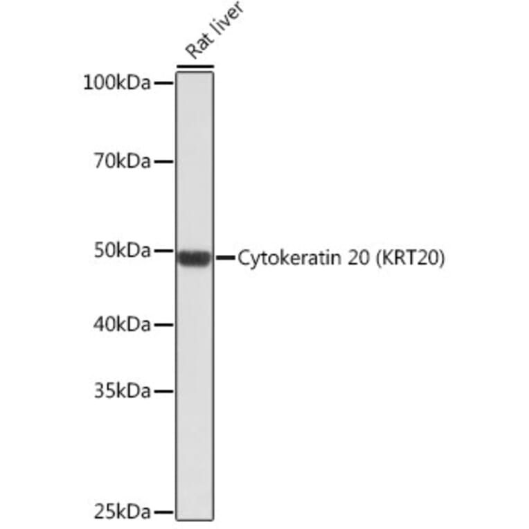 Western Blot - Anti-Cytokeratin 20 Antibody [ARC0288] (A306519) - Antibodies.com