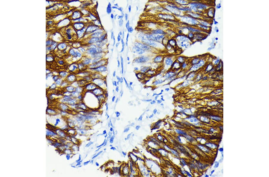 Immunohistochemistry - Anti-Cytokeratin 20 Antibody [ARC0288] (A306519) - Antibodies.com