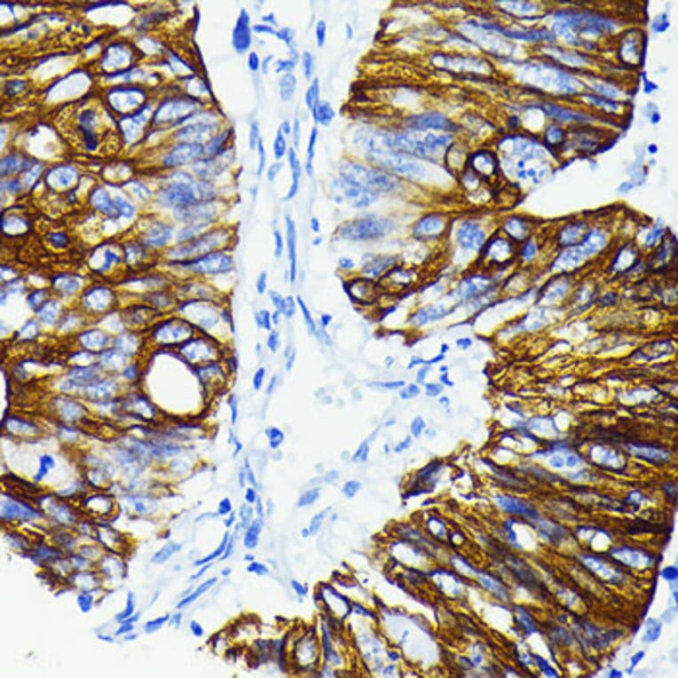 Immunohistochemistry - Anti-Cytokeratin 20 Antibody [ARC0288] (A306519) - Antibodies.com