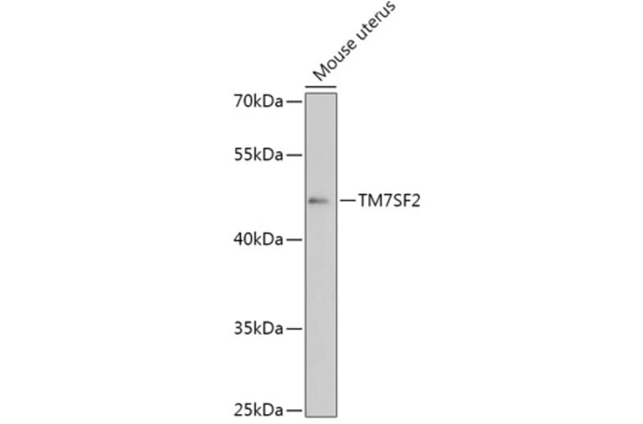 Western Blot - Anti-TM7SF2 Antibody (A306520) - Antibodies.com