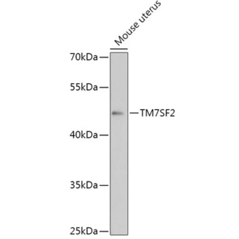 Western Blot - Anti-TM7SF2 Antibody (A306520) - Antibodies.com