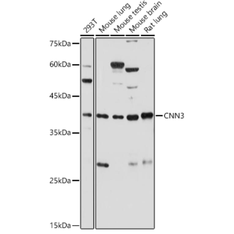 Western Blot - Anti-Calponin 3 Antibody (A306521) - Antibodies.com