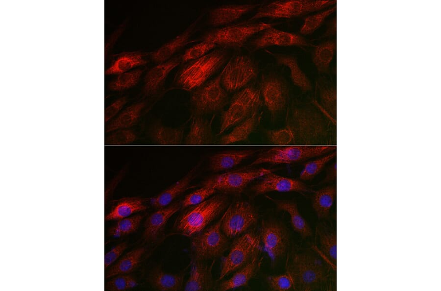 Immunofluorescence - Anti-Calponin 3 Antibody (A306521) - Antibodies.com
