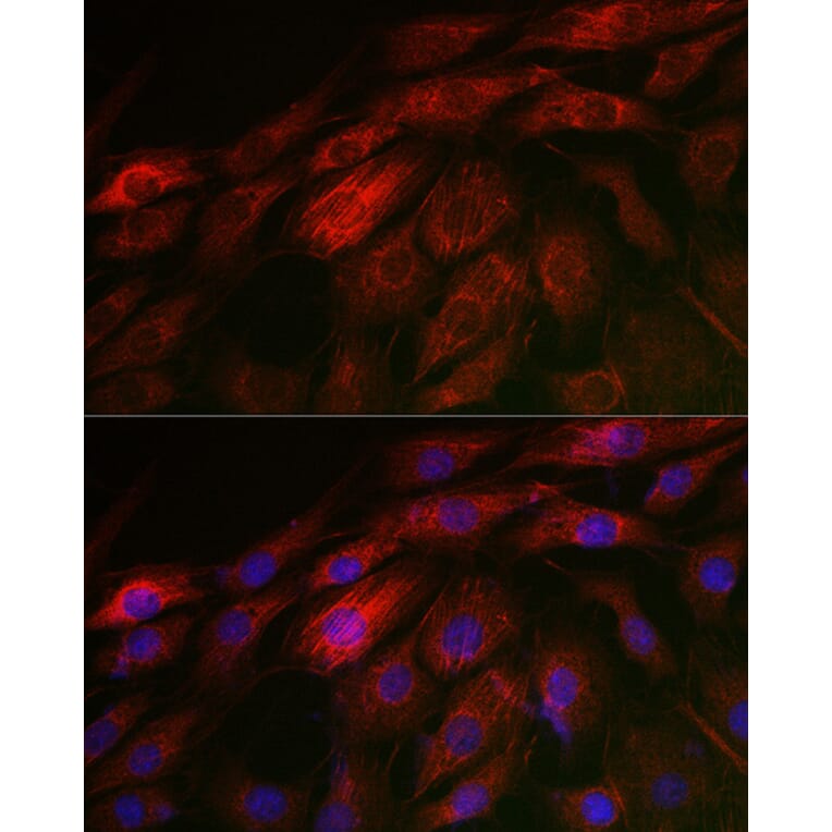 Immunofluorescence - Anti-Calponin 3 Antibody (A306521) - Antibodies.com