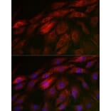 Immunofluorescence - Anti-Calponin 3 Antibody (A306521) - Antibodies.com