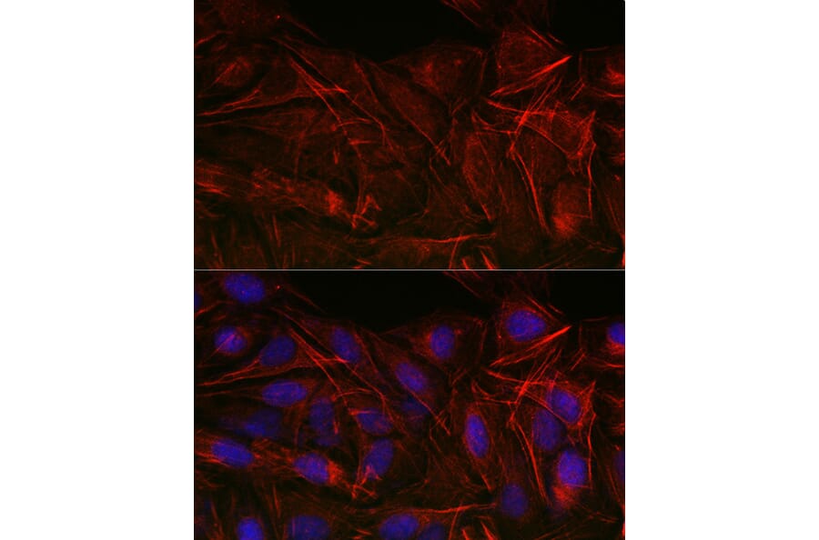 Immunofluorescence - Anti-Calponin 3 Antibody (A306521) - Antibodies.com