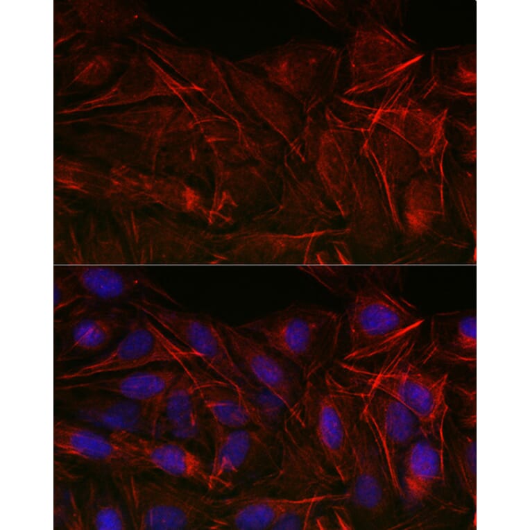 Immunofluorescence - Anti-Calponin 3 Antibody (A306521) - Antibodies.com