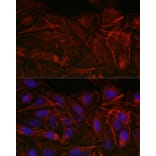 Immunofluorescence - Anti-Calponin 3 Antibody (A306521) - Antibodies.com