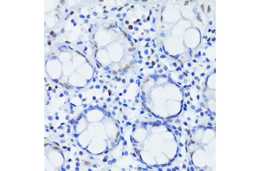 Immunohistochemistry - Anti-HIF1 beta Antibody [ARC0010] (A306522) - Antibodies.com