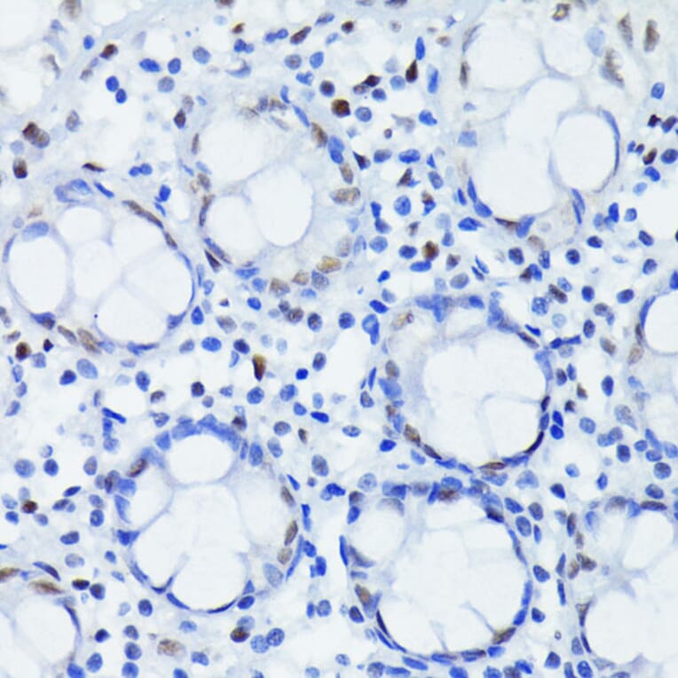 Immunohistochemistry - Anti-HIF1 beta Antibody [ARC0010] (A306522) - Antibodies.com