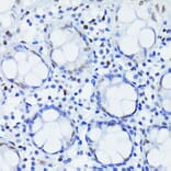 Immunohistochemistry - Anti-HIF1 beta Antibody [ARC0010] (A306522) - Antibodies.com