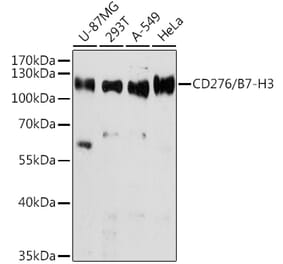 Western Blot - Anti-CD276 Antibody (A306523) - Antibodies.com