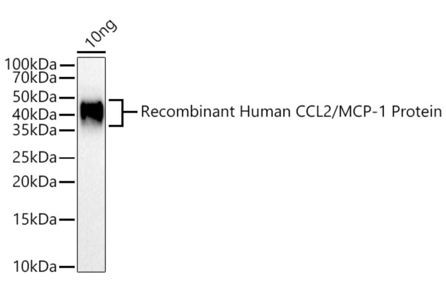 Western Blot - Anti-MCP1 Antibody (A306524) - Antibodies.com