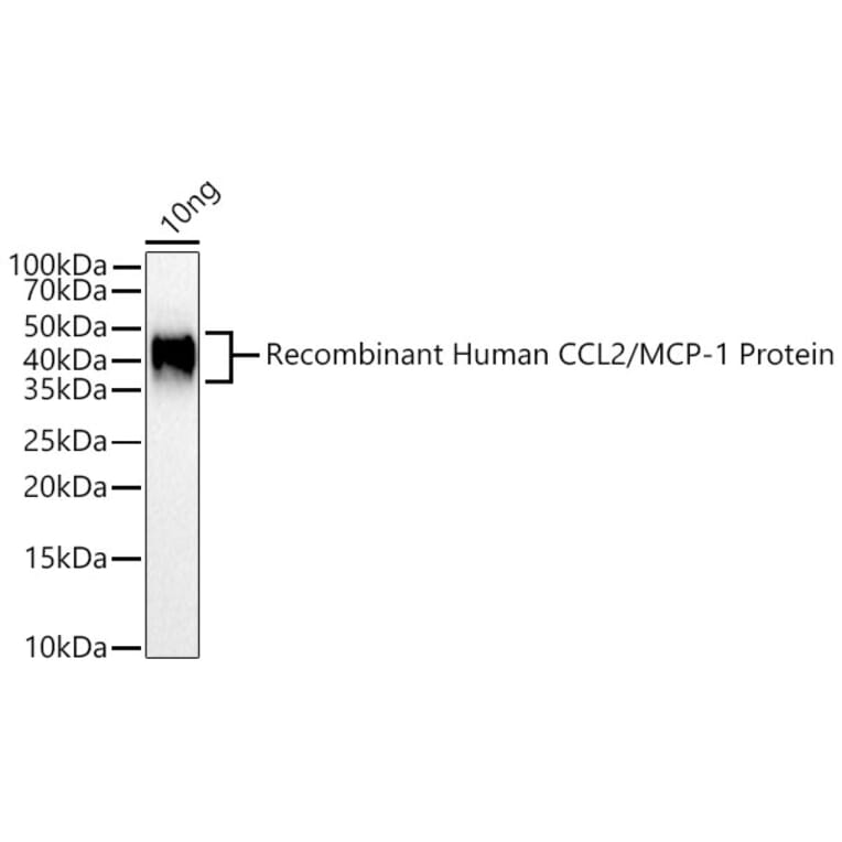 Western Blot - Anti-MCP1 Antibody (A306524) - Antibodies.com