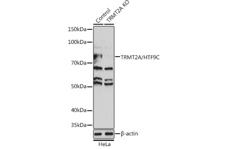 Western Blot - Anti-HTF9C / TRMT2A Antibody (A306527) - Antibodies.com