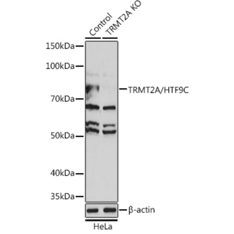 Western Blot - Anti-HTF9C / TRMT2A Antibody (A306527) - Antibodies.com