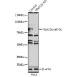 Western Blot - Anti-HTF9C / TRMT2A Antibody (A306527) - Antibodies.com