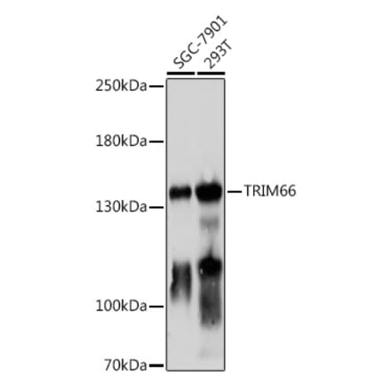 Western Blot - Anti-TRIM66 Antibody (A306528) - Antibodies.com