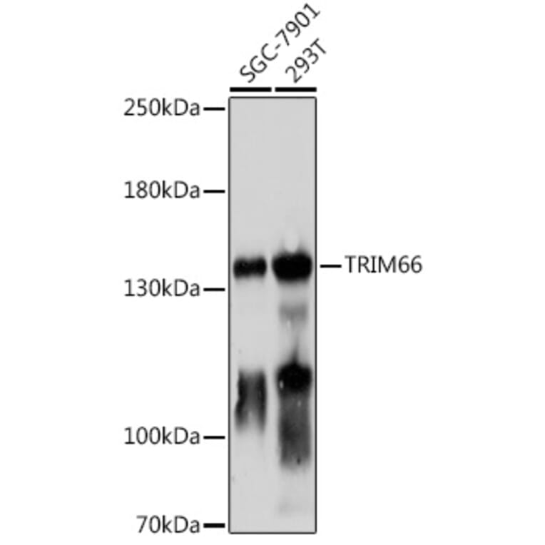Western Blot - Anti-TRIM66 Antibody (A306528) - Antibodies.com