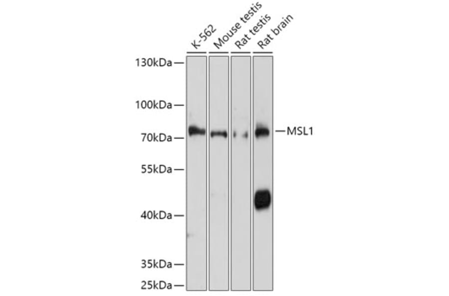 Western Blot - Anti-MSL1 Antibody (A306530) - Antibodies.com