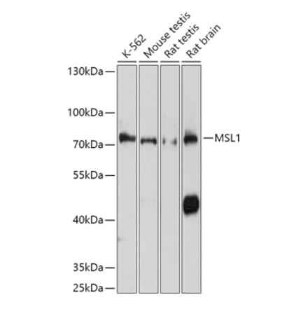 Western Blot - Anti-MSL1 Antibody (A306530) - Antibodies.com