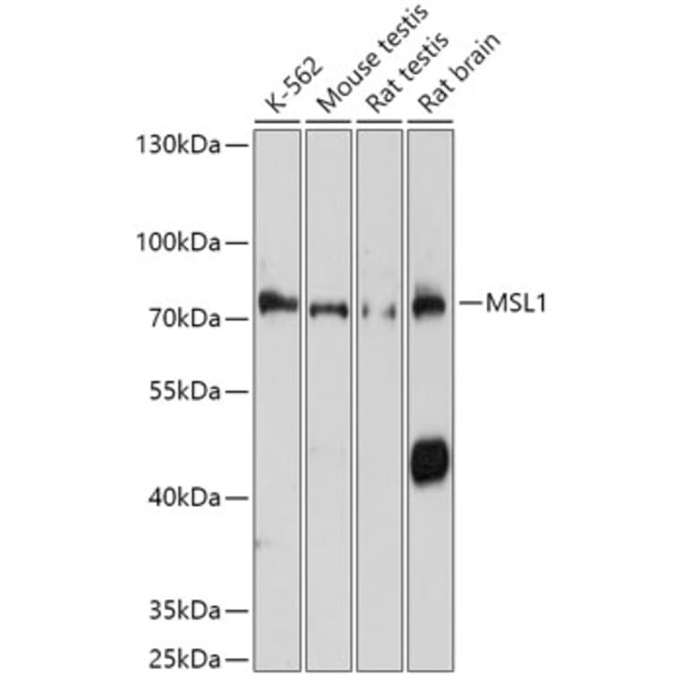 Western Blot - Anti-MSL1 Antibody (A306530) - Antibodies.com