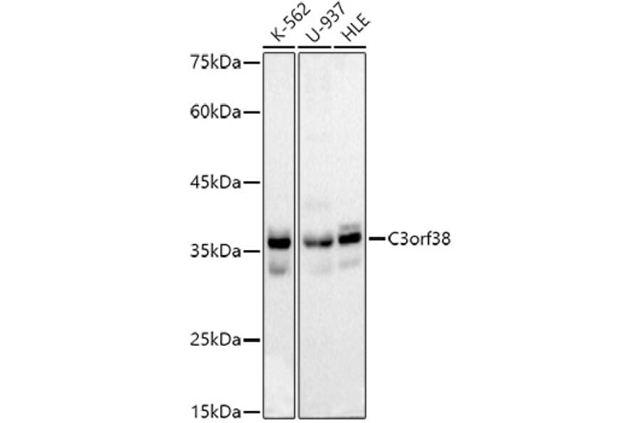 Western Blot - Anti-C3orf38 Antibody [ARC2917] (A306531) - Antibodies.com