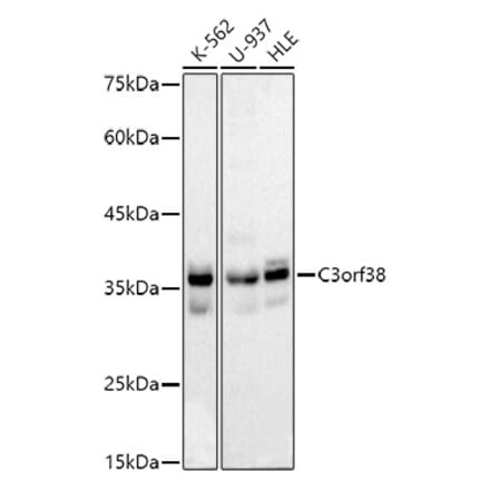 Western Blot - Anti-C3orf38 Antibody [ARC2917] (A306531) - Antibodies.com