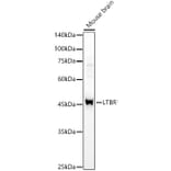 Western Blot - Anti-LTBR Antibody (A306532) - Antibodies.com