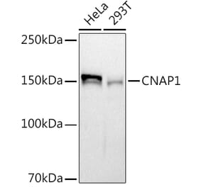 Western Blot - Anti-NCAPD2 Antibody [ARC2757] (A306533) - Antibodies.com
