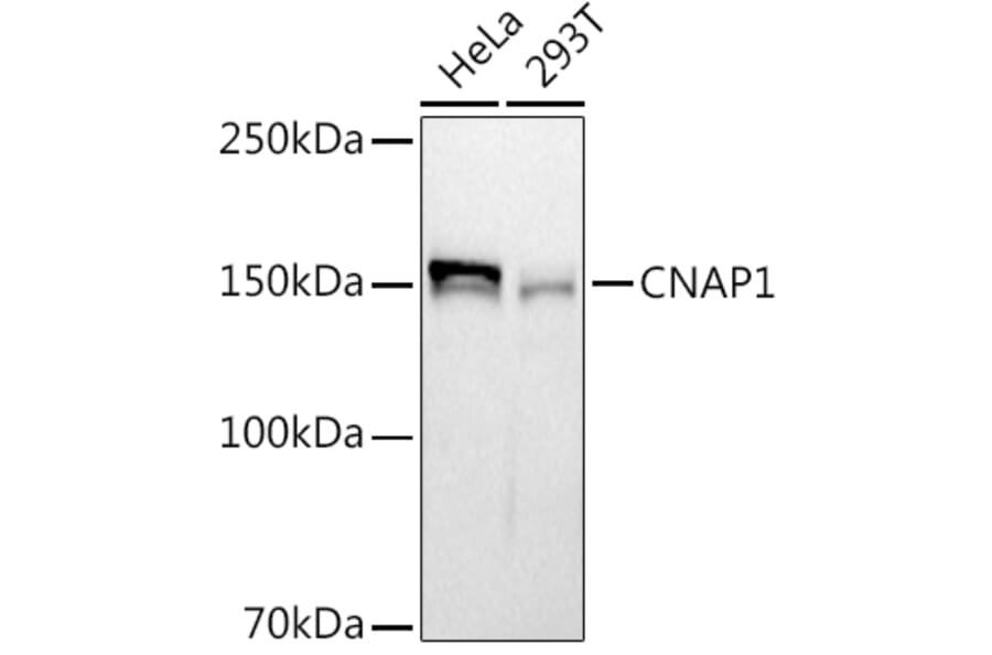 Western Blot - Anti-NCAPD2 Antibody [ARC2757] (A306533) - Antibodies.com