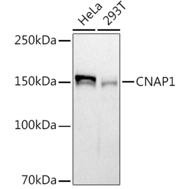 Western Blot - Anti-NCAPD2 Antibody [ARC2757] (A306533) - Antibodies.com
