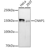 Western Blot - Anti-NCAPD2 Antibody [ARC2757] (A306533) - Antibodies.com