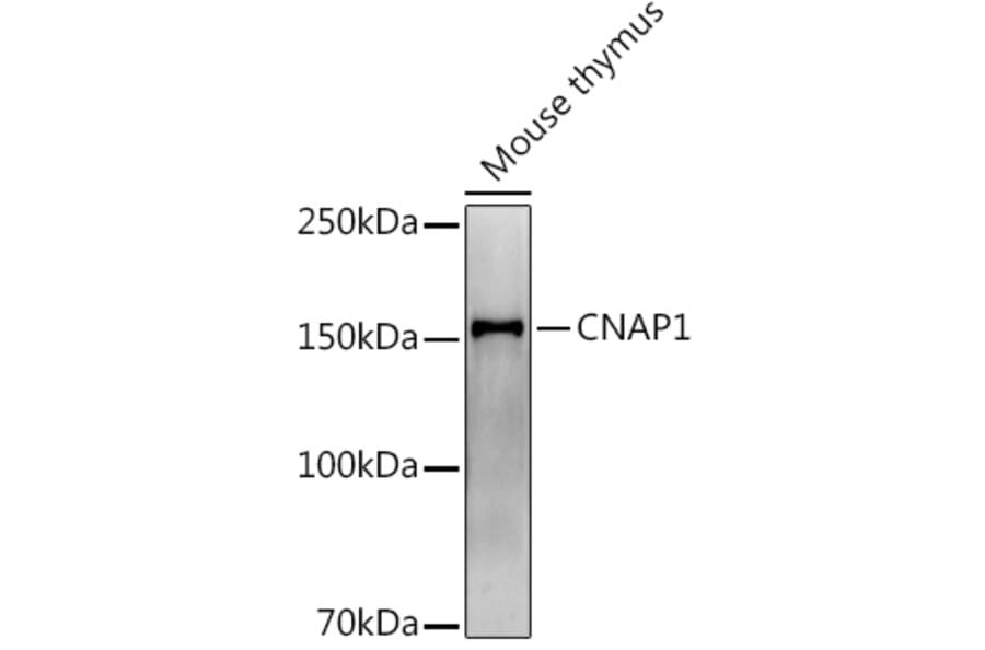 Western Blot - Anti-NCAPD2 Antibody [ARC2757] (A306533) - Antibodies.com