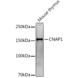 Western Blot - Anti-NCAPD2 Antibody [ARC2757] (A306533) - Antibodies.com