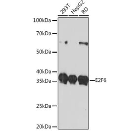 Western Blot - Anti-E2F6 Antibody [ARC0628] (A306534) - Antibodies.com