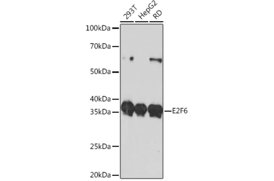 Western Blot - Anti-E2F6 Antibody [ARC0628] (A306534) - Antibodies.com