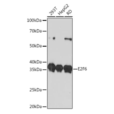 Western Blot - Anti-E2F6 Antibody [ARC0628] (A306534) - Antibodies.com