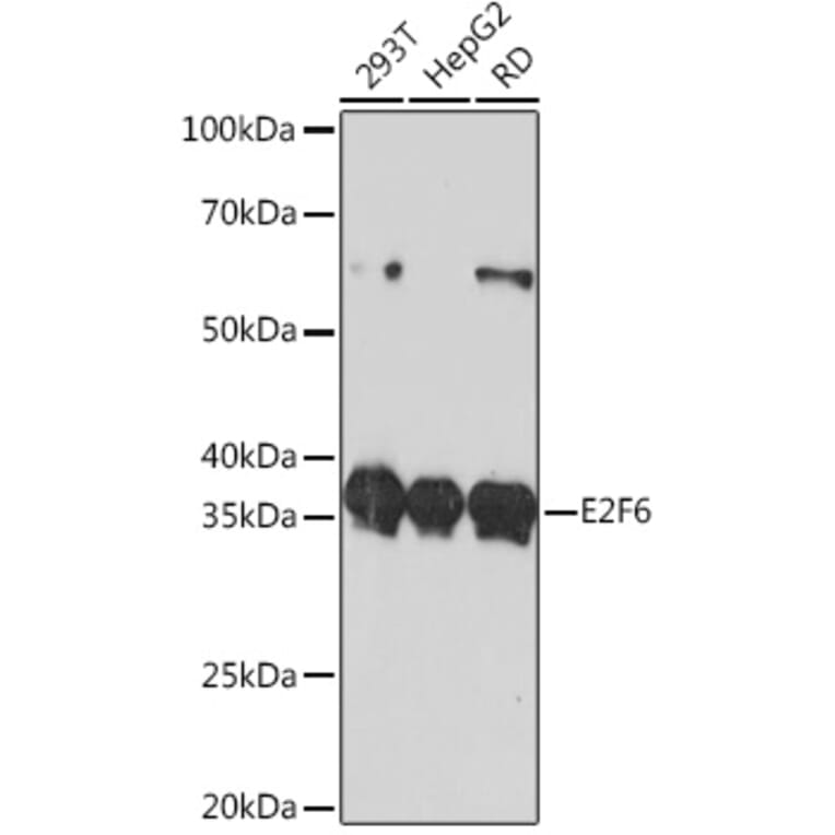 Western Blot - Anti-E2F6 Antibody [ARC0628] (A306534) - Antibodies.com
