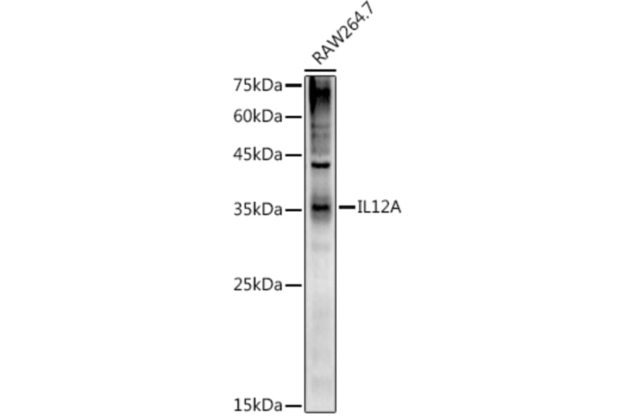 Western Blot - Anti-IL-12A Antibody (A306535) - Antibodies.com